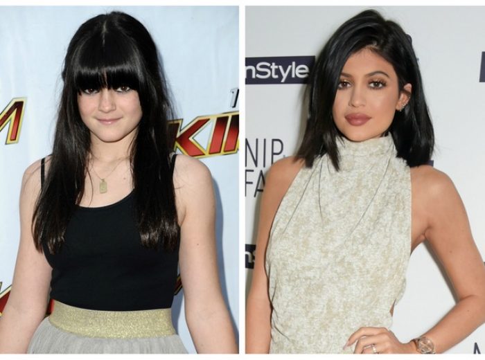 kylie-jenner-do-posle